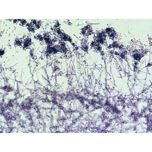Bresser Muestras (25 Piezas) Preparadas Para Microscopio 2 Bresser Muestras (25 Piezas) Preparadas Para Microscopio - Imagen 2